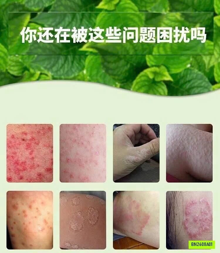 COMBO 3 TUÝP THUỐC NGỨA
