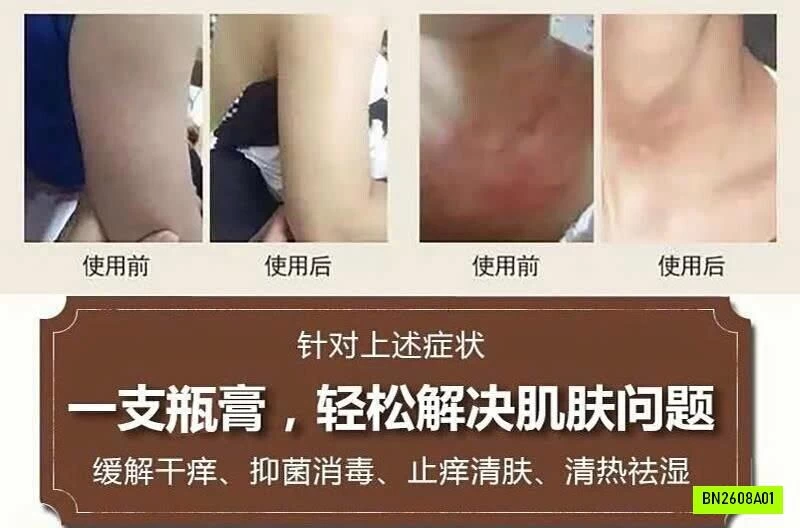 COMBO 3 TUÝP THUỐC NGỨA