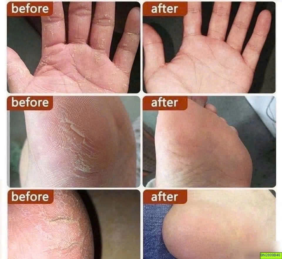 DẦU NGỰA ĐẶC DƯỠNG DA TAY CHÂN